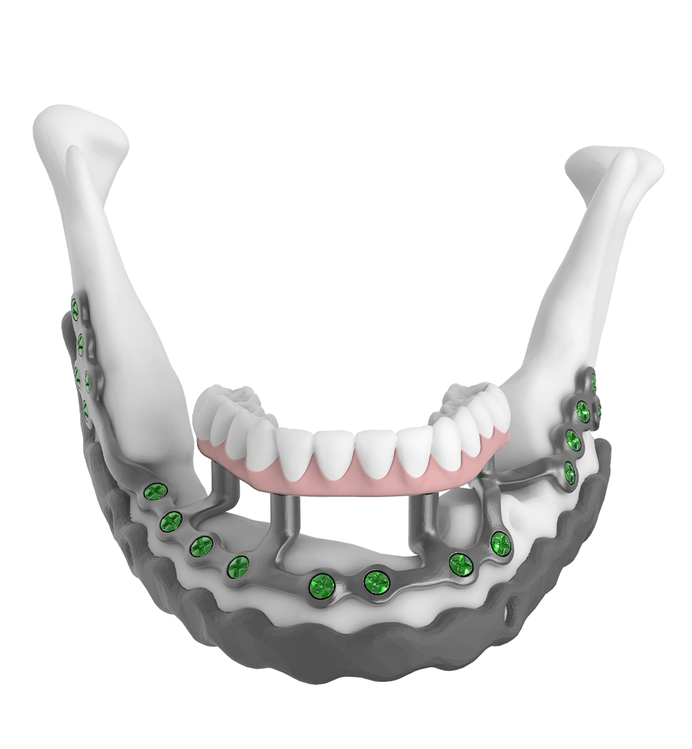 casestudies-post reconstruction