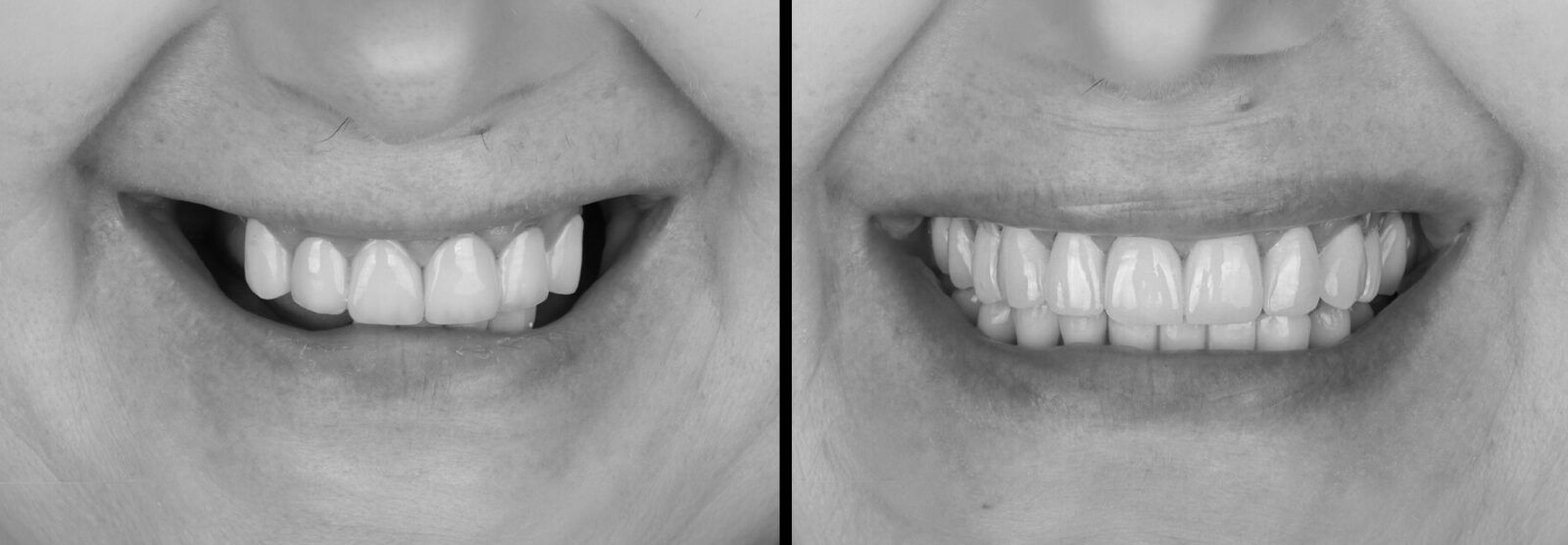 smile gallery before and after