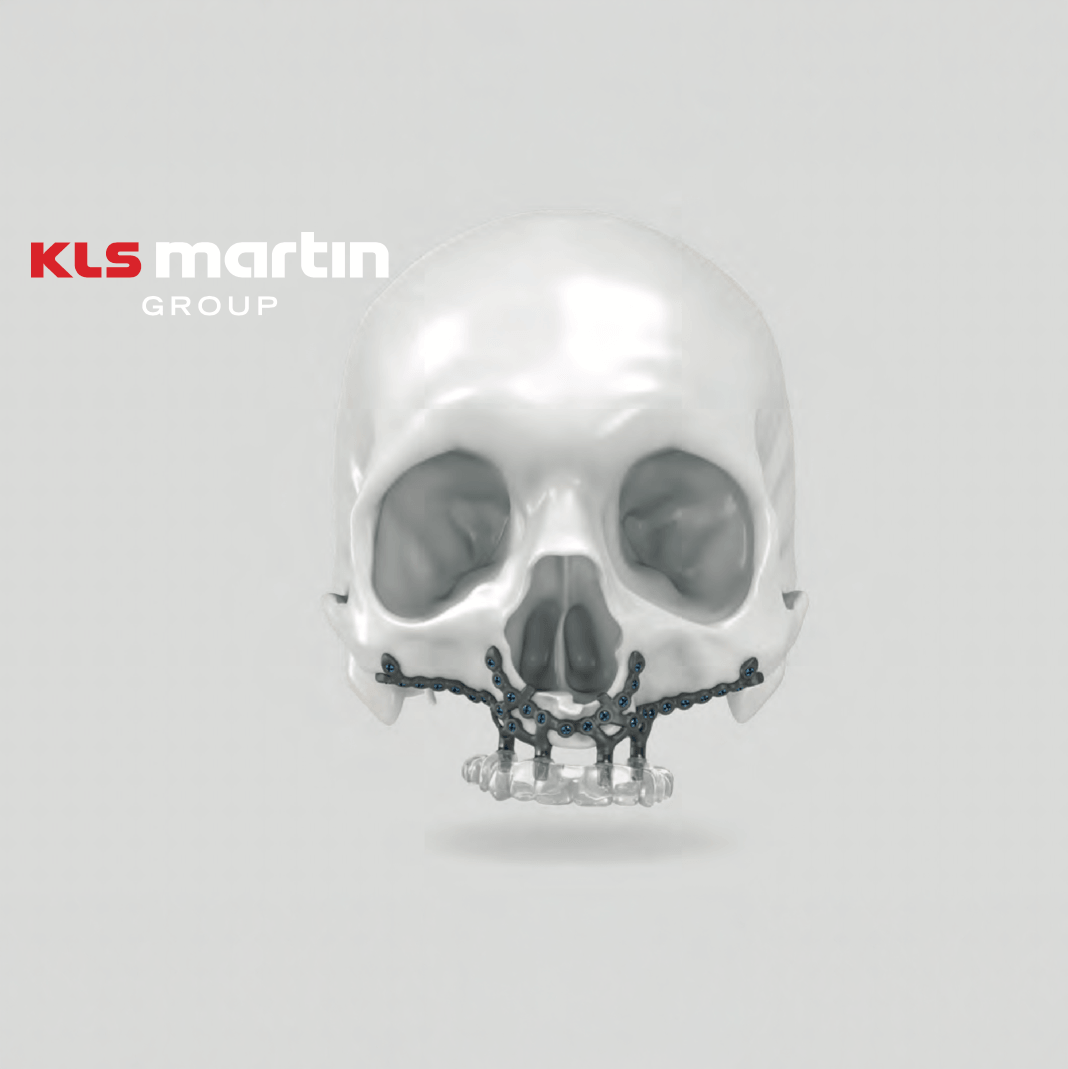 KLS Martin Flyer