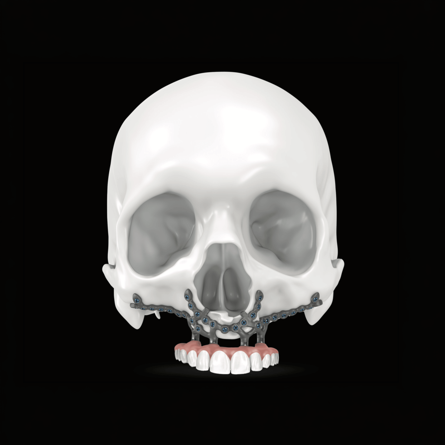 IPS Preprosthetic system