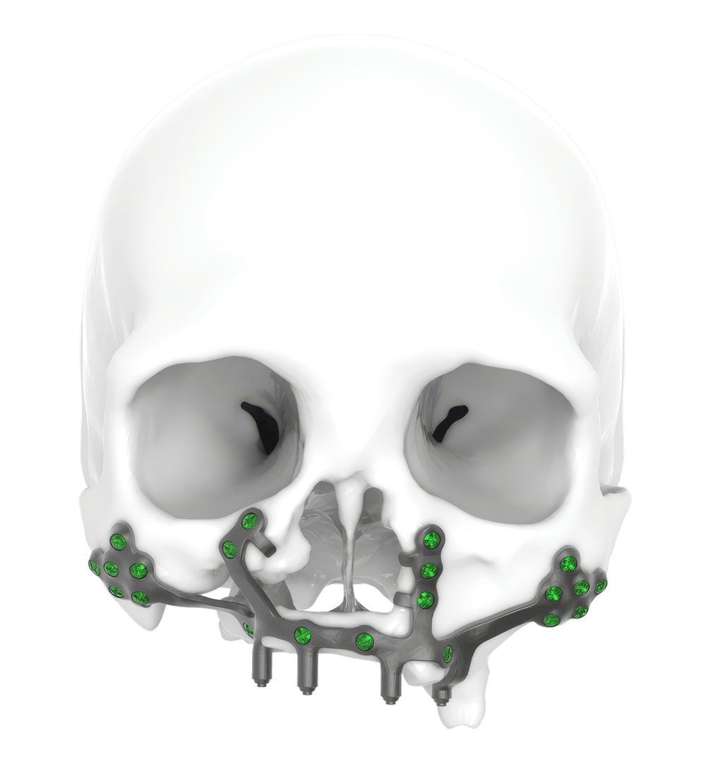 casestudies-Post Reconstruction
