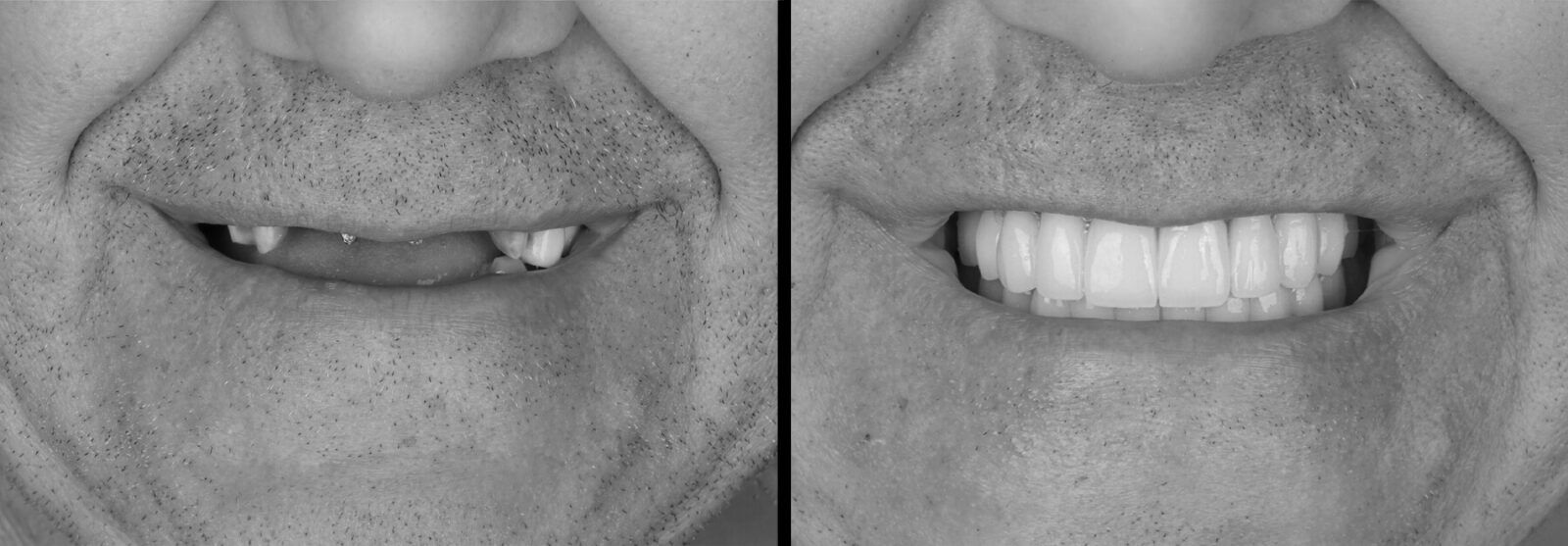Before and after smile gallery