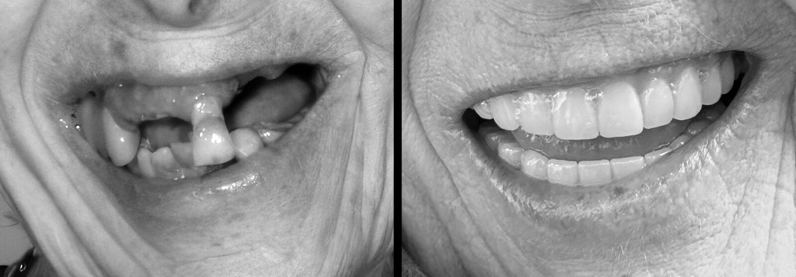 Before and after smile gallery