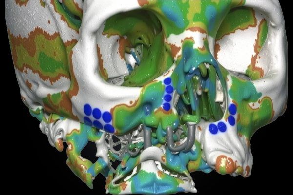 3D imaging and collaborative digital diagnosis