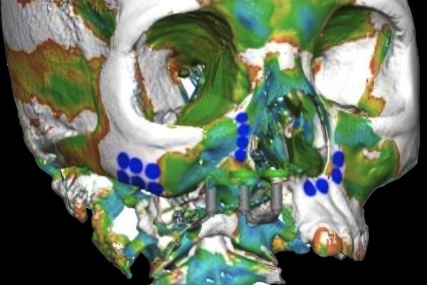 3D imaging and collaborative digital diagnosis