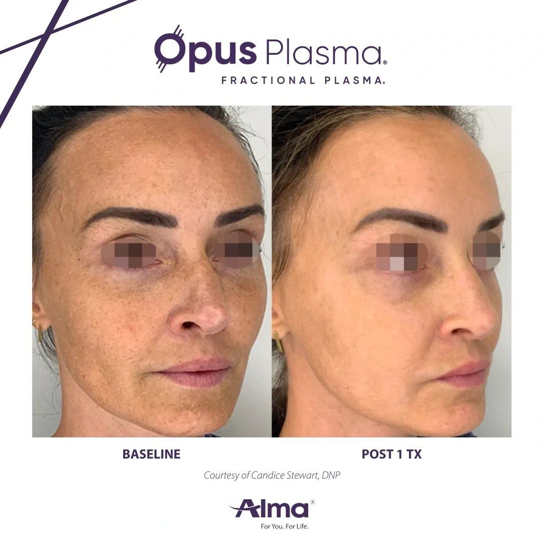 Patient Before & After treatment