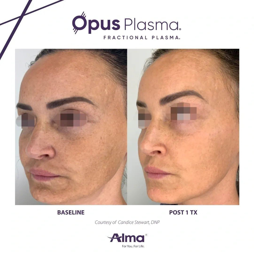 Patient Before & After treatment