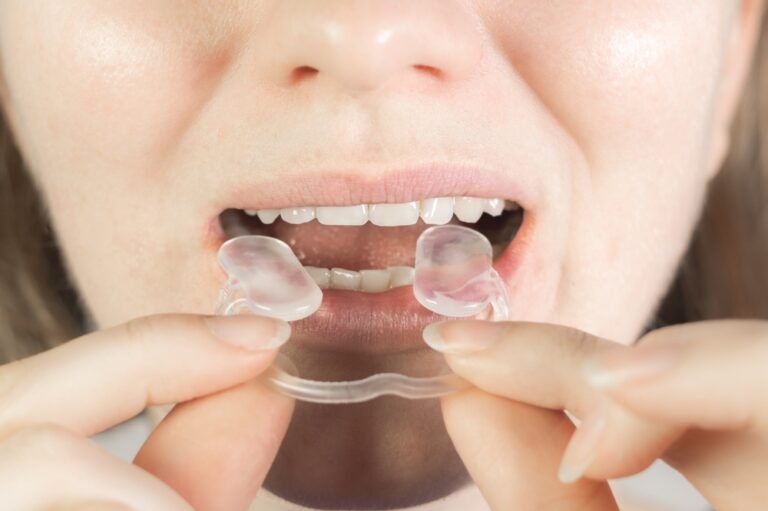 Woman puts Soft mouth guard for TMJ, TMD in her mouth. Teeth protection