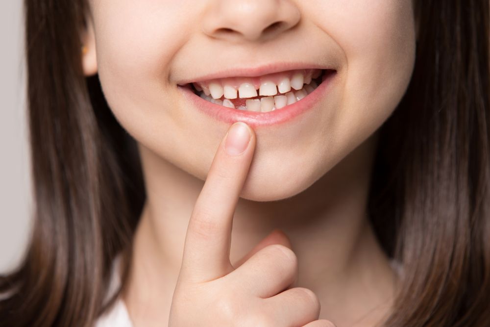 preschool cute girl widely smiling, showing empty space with growing first permanent molar