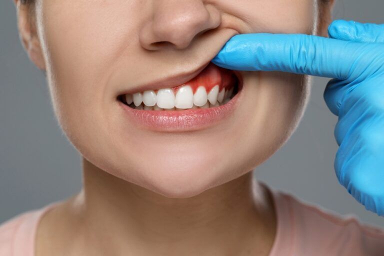 Doctor examining woman's inflamed gum on grey background, closeup
