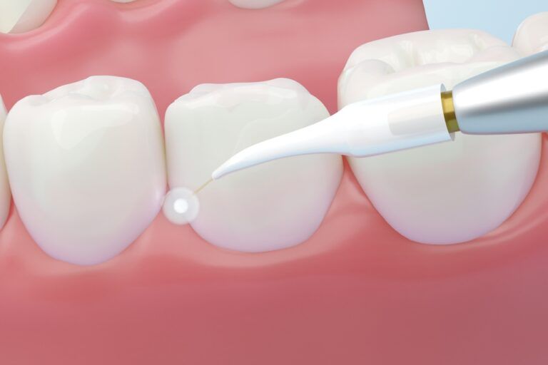 Dental laser with healthy white teeth and pink gums, 3D rendering.