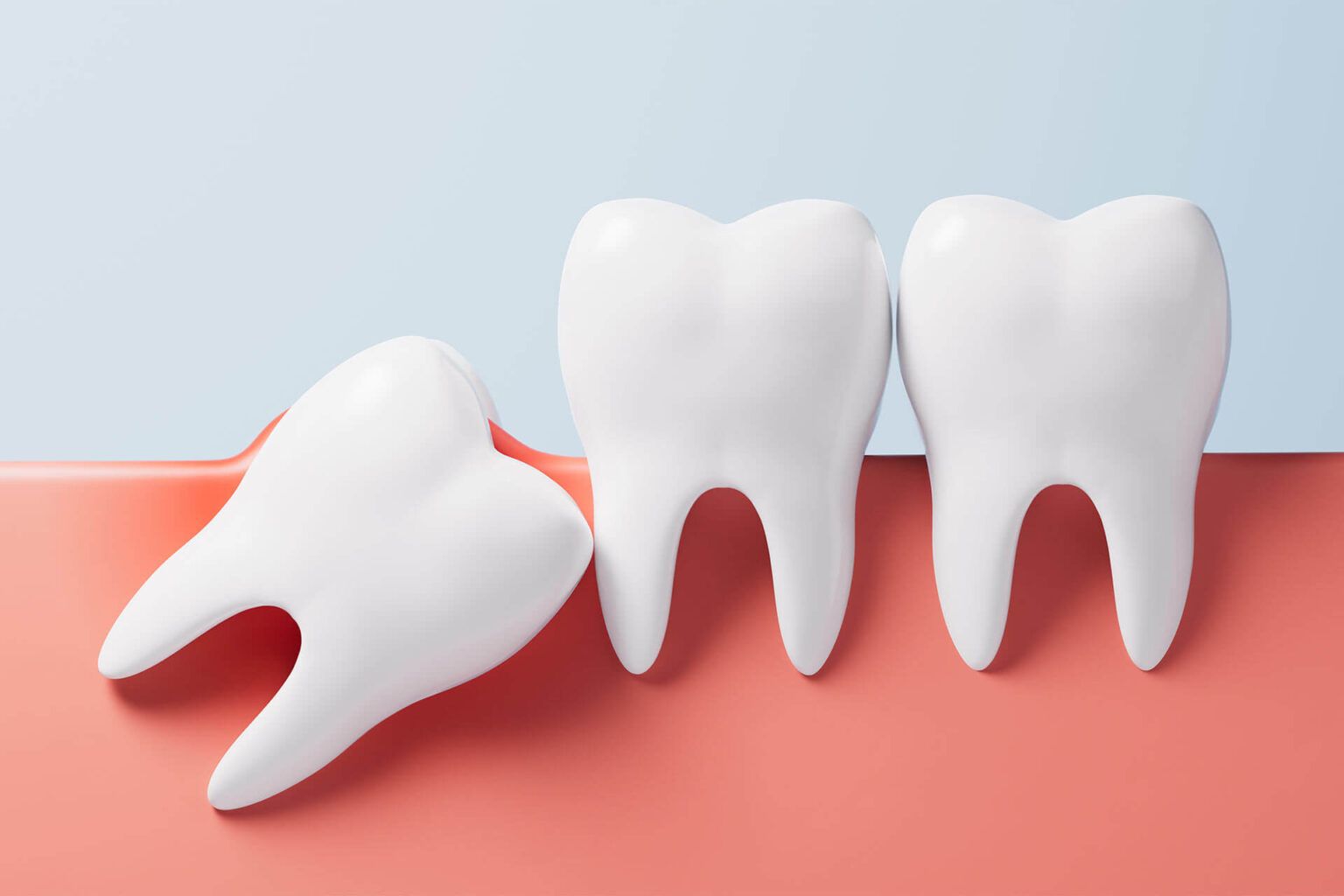 Wisdom Teeth & Oral Surgery