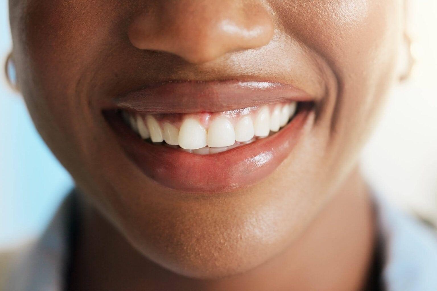 Dental hygiene, mouth and woman with smile, wellness and remove plaque with teeth whitening