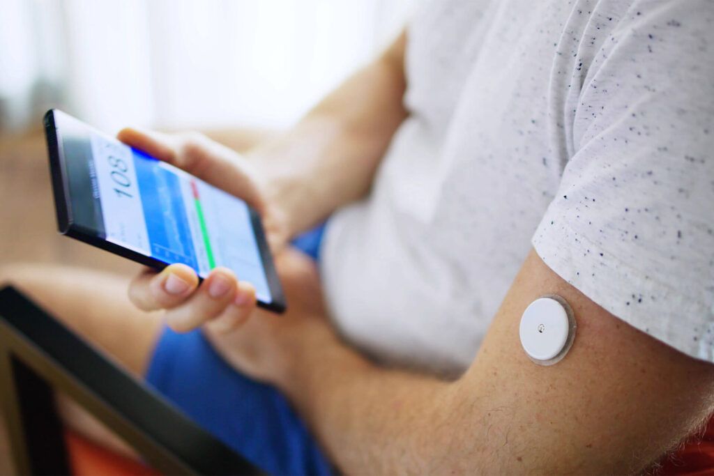 Continuous Glucose Monitoring