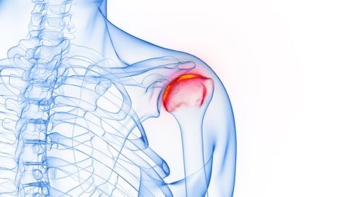 3d,Rendered,Medical,Illustration,Of,Male,Anatomy,-,Inflamed,Shoulder