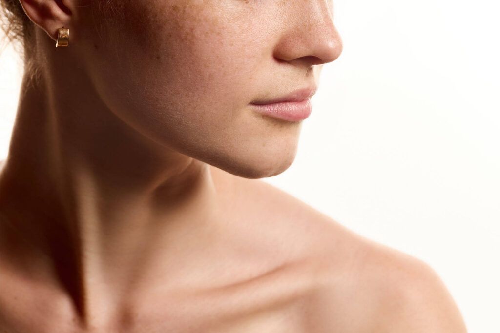 Facial Volume Loss