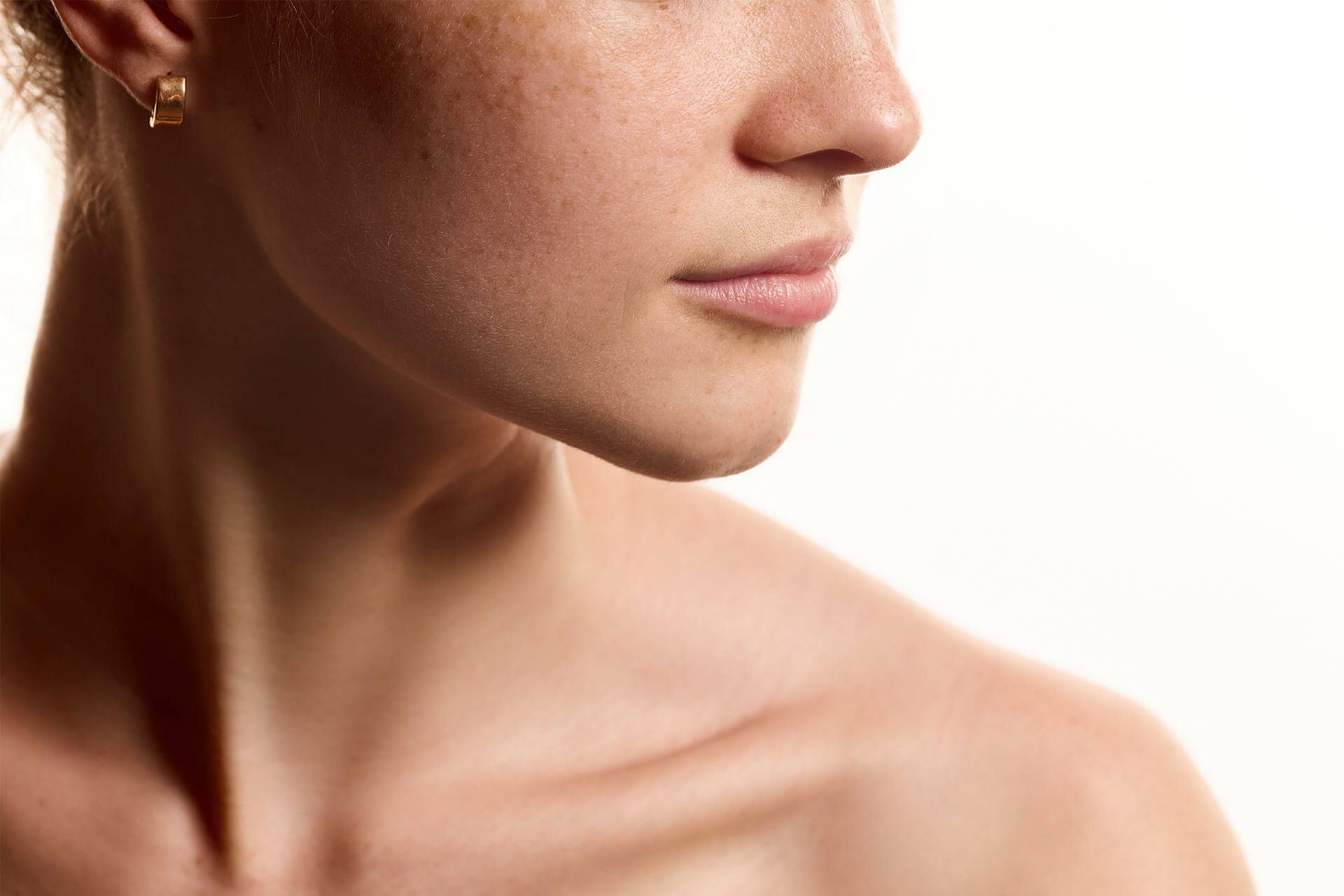 Facial Volume Loss