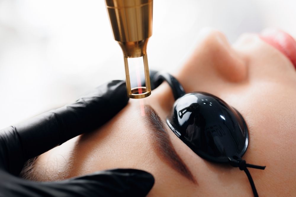 Laser removal of tattoo permanent makeup eyebrow of young woman in salon.