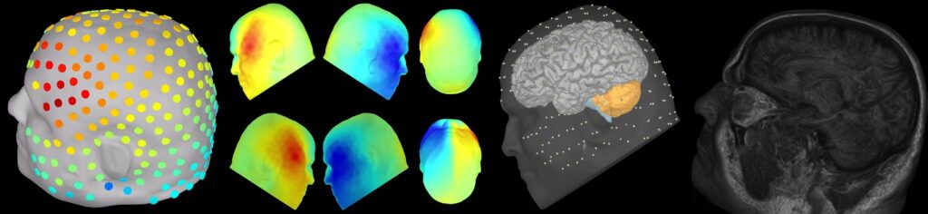 Brain Performance Evaluation