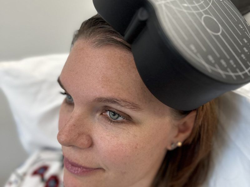 Patient receive a series of TMS treatments designed to restore healthy neural connections