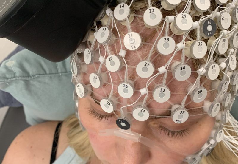 electro-encelography (EEG)