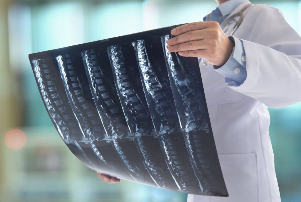 doctor surgeon look at spine x-ray film of patient at operating room.
