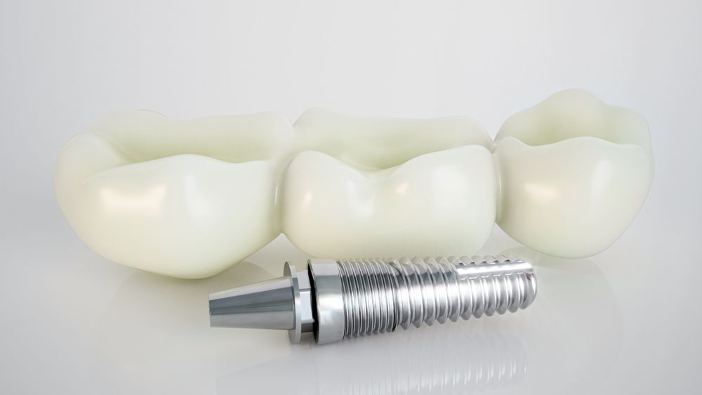 Treatment of Failing & Ailing Dental Implants
