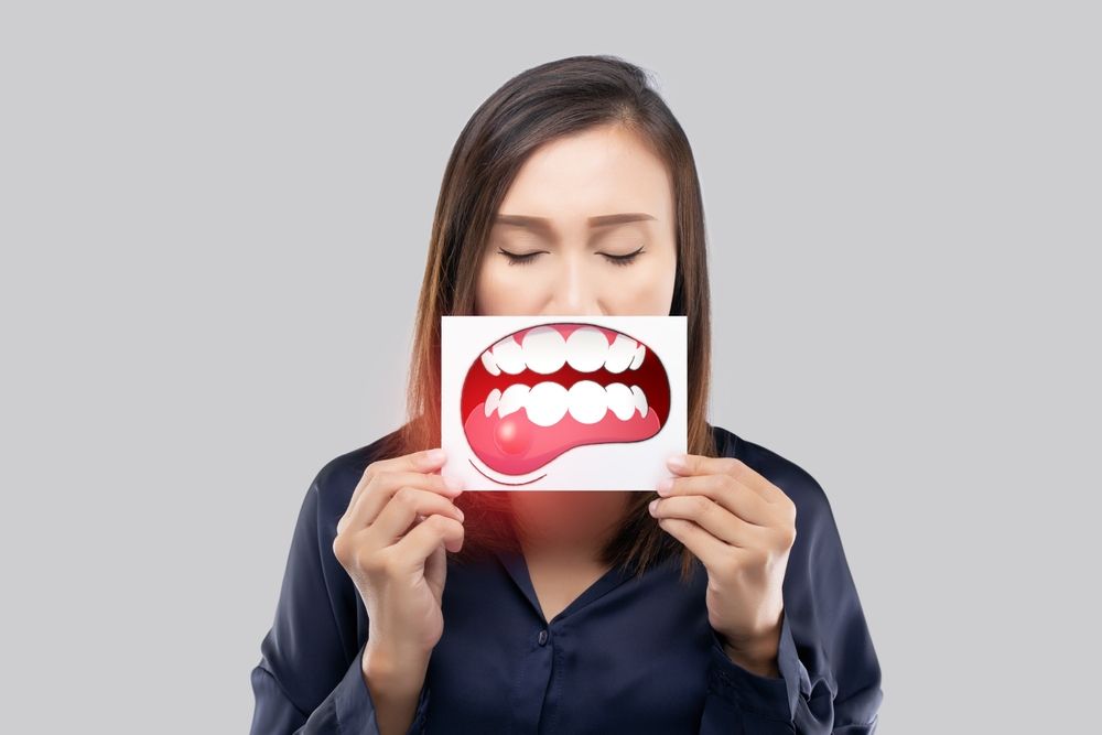 Periodontal disease, Gingivitis or inflammation of the gums