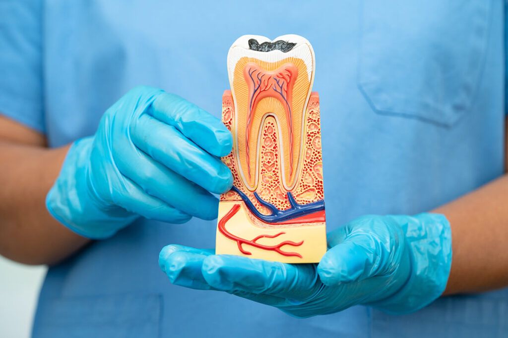 a anatomical model of a human molar used to demonstrate root canal treatment